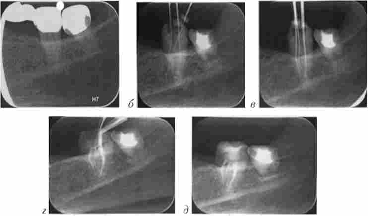 ������� X., 52 ����. ³��������