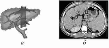 ������������������� ����� ��������� �������糿 (���������� ������� ������� � ��������� ��������)