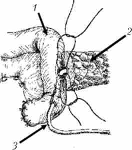 ����������� ����� ���������� �����������������������