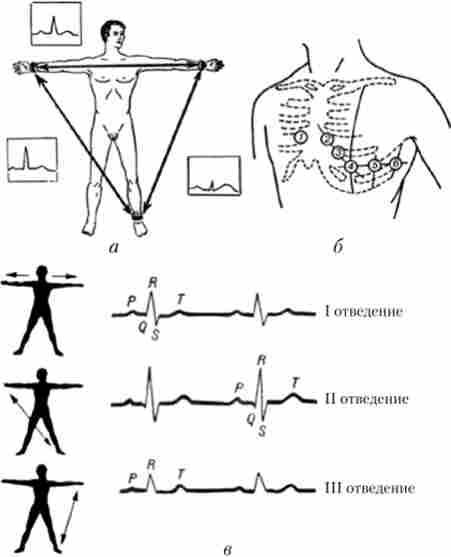 ��������� ���