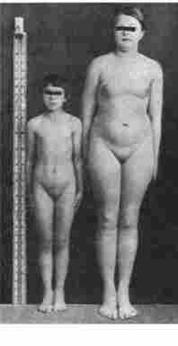 ó������� - ��������� ����������� �������