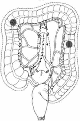 ����������� ���������