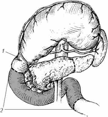 ϳ���������������� ��������������������� ��������. ��� ��������� �� ��������