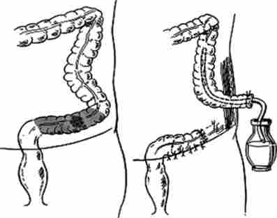 ������������ �������� ���������� ����� (�������� ��������)