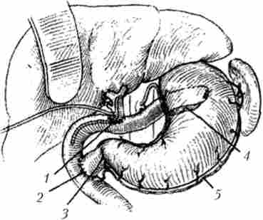 ���������������� ���� ����������������� ��������������������� ��������