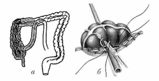 ��������� ��������