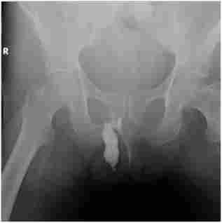 Գ����������� (���� ����� ����� � �������������� �������)