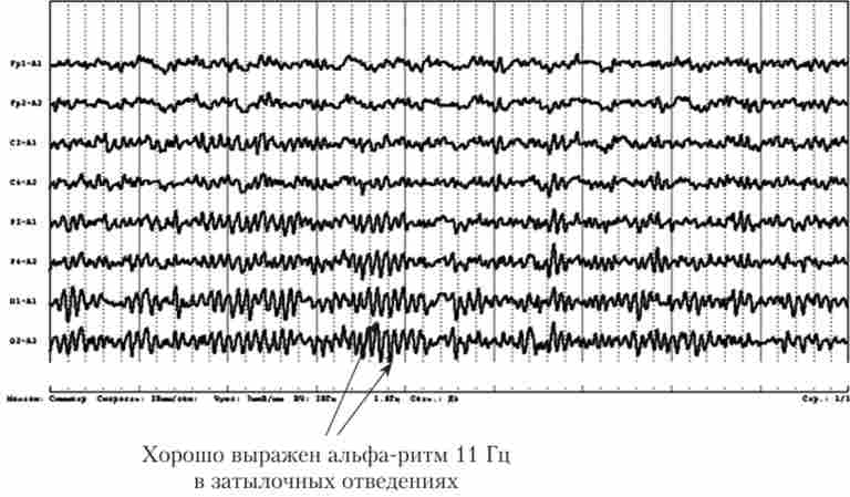 ������� ��������� ��� ������� ������� ������ � ����� ������ �� ��������� �����