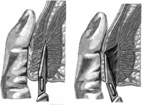 ������� ��������������