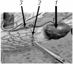 ��������� �������� ���������� ������ - �����'���� ����������� ����� � ������� ������� ���������� ������