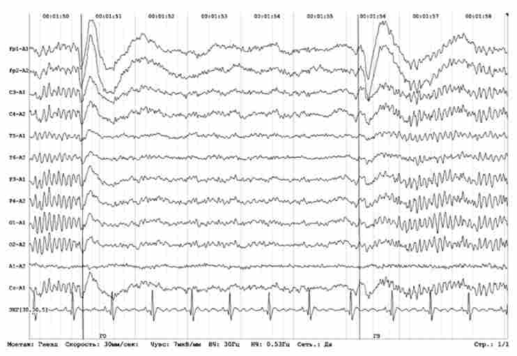 ������� ��������� (������ �����-�����, arousal, ���������������)