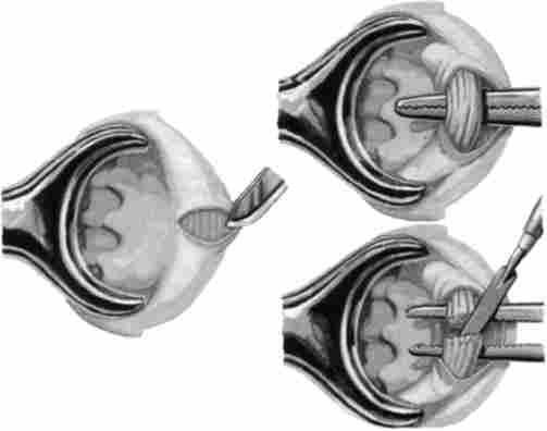 ������� ��������������