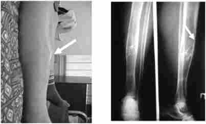 ���������� ���������� ����� �������������� ����� (���������������� ����) � �����, �� ��������� ��������� ��������������