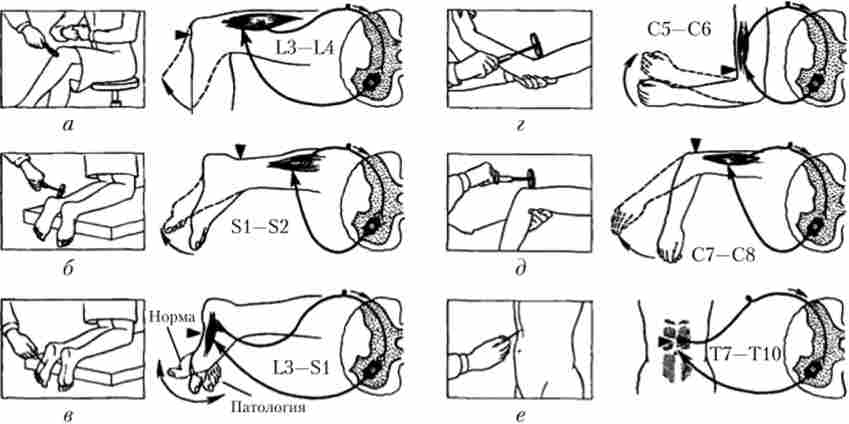 �������� �������� �����