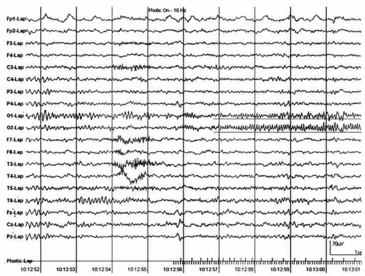 ������� �������� ����� �������������� 16 �� � ���������� �������� �����