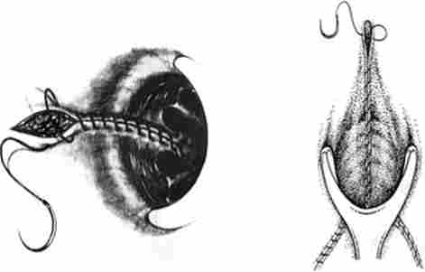 ����� ������������쳳 �� ���������