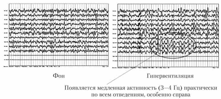 ��� ������ 9 ���� � �� � �� ��� ��������������