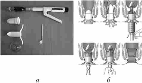 ���������� �������� ������ ��������-����������� ���� ����������� ����� ����� ����� �� ��������� ������������ ����� �������