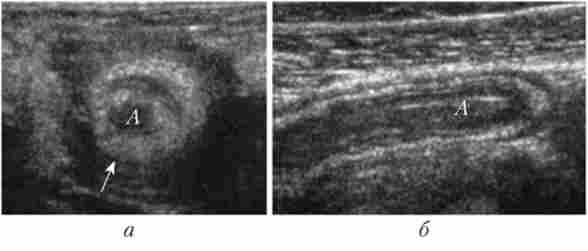 ������������� ������� ��� �������� ������������ ���������