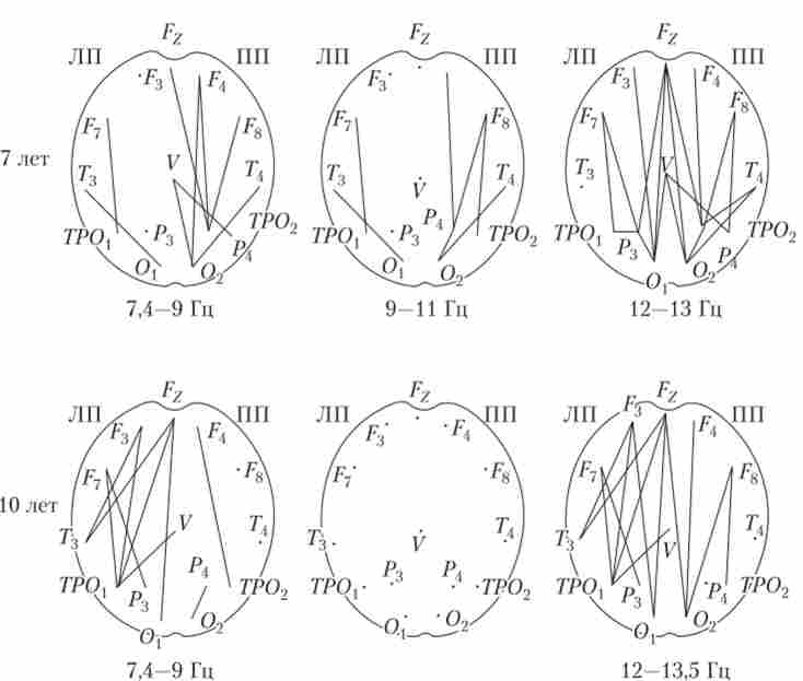 �������������. ������������� ��'������� �������� ���� �. �. �� ����� �������� ��������� ����� � ���� 7 � 10 ���� ��� ��������� ��������