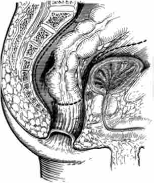 ��� �������� ������������� ���������