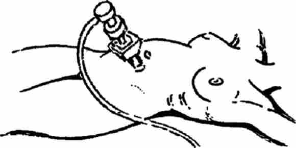 ĳ���������� �����������. ���������� �������� � ������� ���������