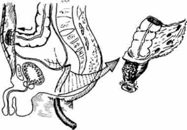 ����� ������-���������� ����������� ����� �����