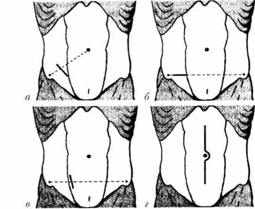 ������� ��� �������� ���������