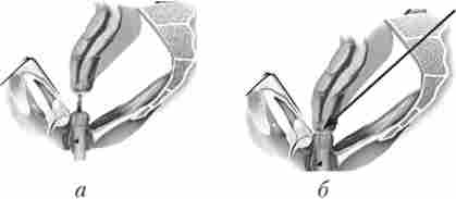 ����� ���������� ��������������� ���������� �� ��������� ����� ������������ ������� ��� ��������� �������� �������� ����� �����