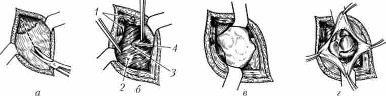 ������ ���-�����