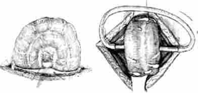 ����������� ���������