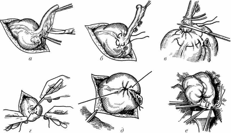 ����� ������� ���������쳿