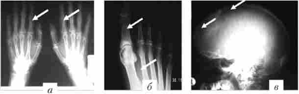 ��������� ���������� � ���������� ��� (��������� ��������) � ����� ��������� ���������������