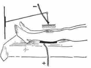 ������ �������������