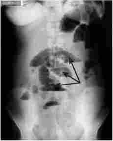 �������� ������������� ������