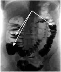 ������������������ ���������� ������