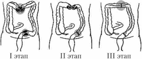 ����������� �������� ���������� ����� �� ������� - ��������